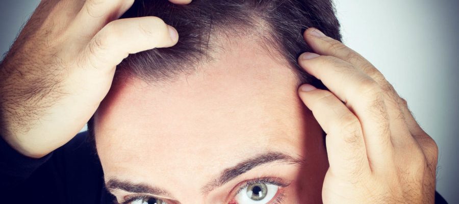 Méthodes de Traitement Médical Pour la Perte de Cheveux | Maral Hair